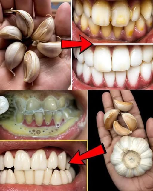 484494785 122169872156531585 4970389994694050692 N